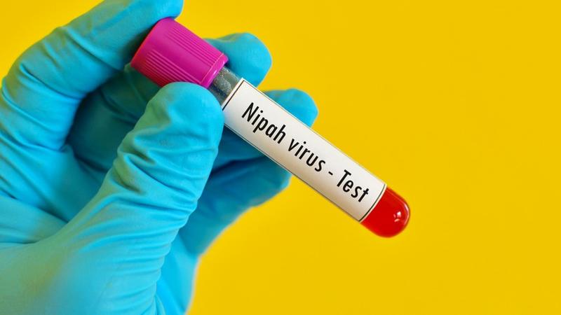 Nipah Virus Health Advisory