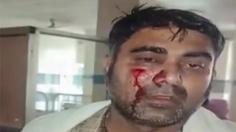 PTI journalists attacked