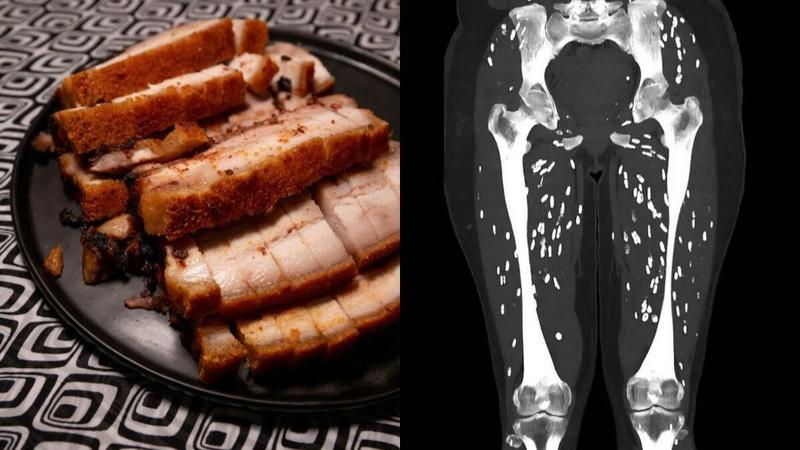  shocking CT scan 