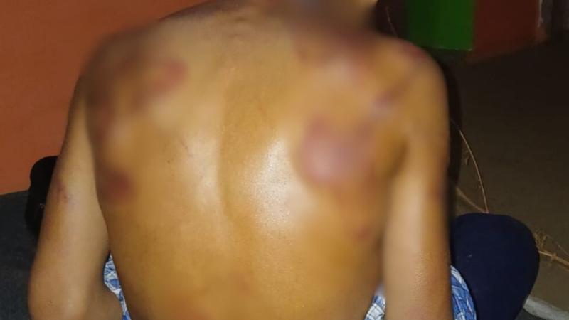 Student Beaten Mercilessly in J&K School, Teacher Suspended After Disturbing Images Go Viral