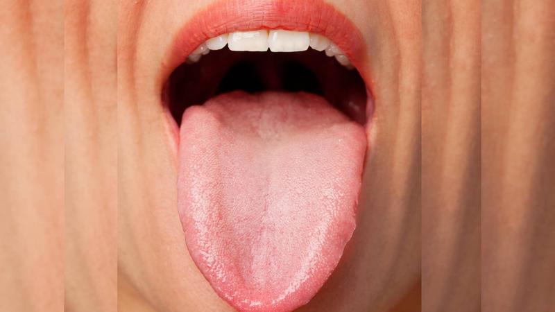 white tongue causes in hindi