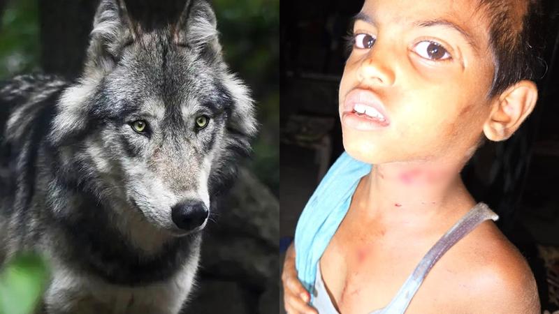 wolf-attacked-on-child