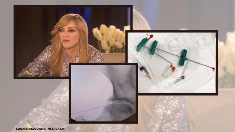 Madonna shares pictures from her stem treatment for knee injury; says ...