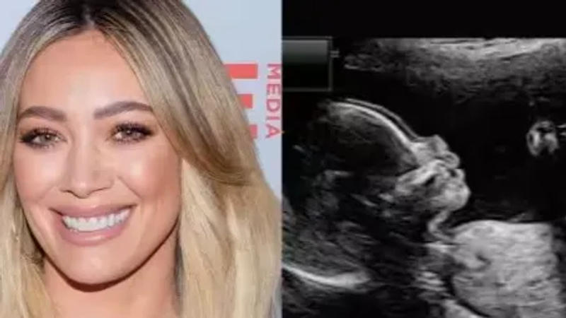 Hilary Duff's pregnancy confirmation