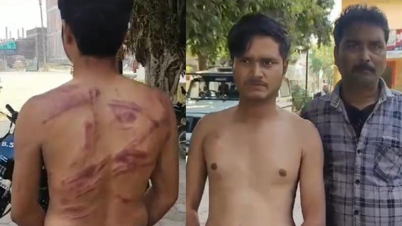 Youth beaten with sticks and leather belt for 2 hours
