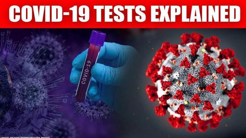 Explainer: What does false positive and false negative coronavirus test results mean?