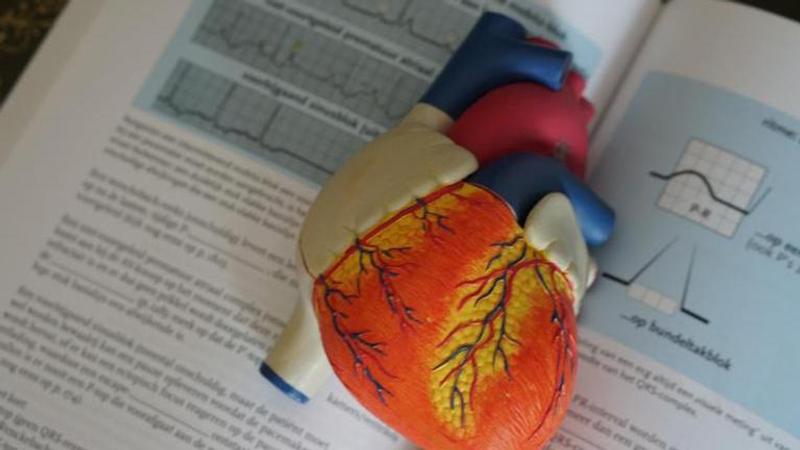 Demystifying Heart Attacks