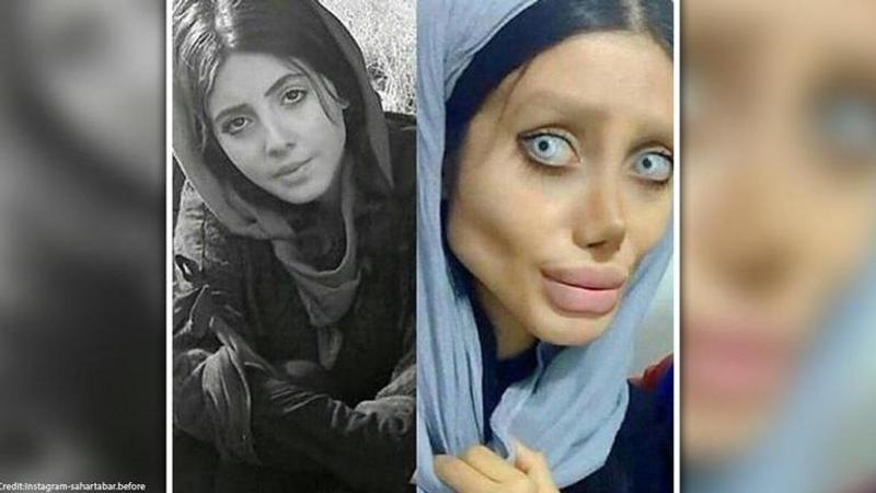 Instagram star who underwent surgeries to look like Angelina Jolie catches coronavirus