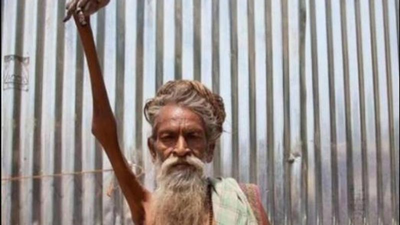 Meet the man whose arm has been raised for almost 50 years