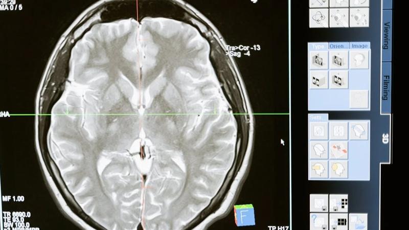 World's Most Powerful Scanner Reveals First Image of Human Brain