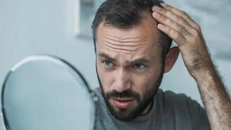 All You Need To Know To Reduce Hair Thinning In Men