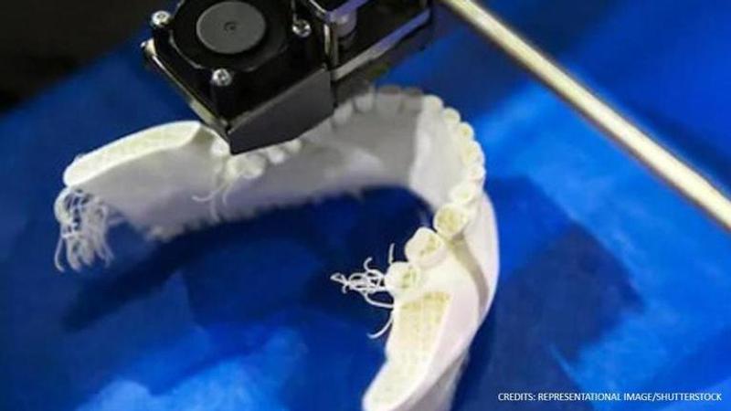 3D-Printed Jaw