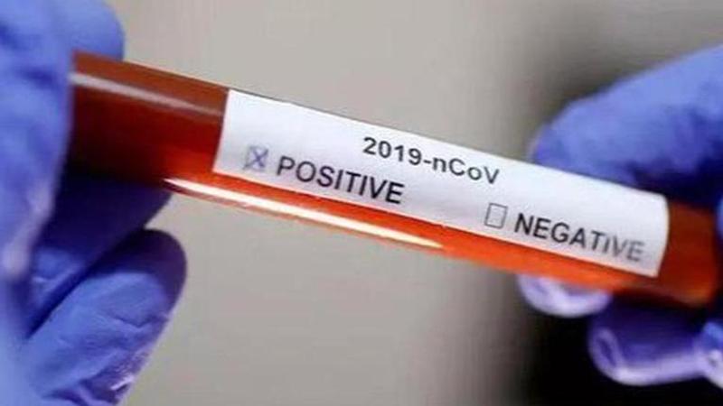 New Zealand reports two new COVID-19 cases after couple tests positive