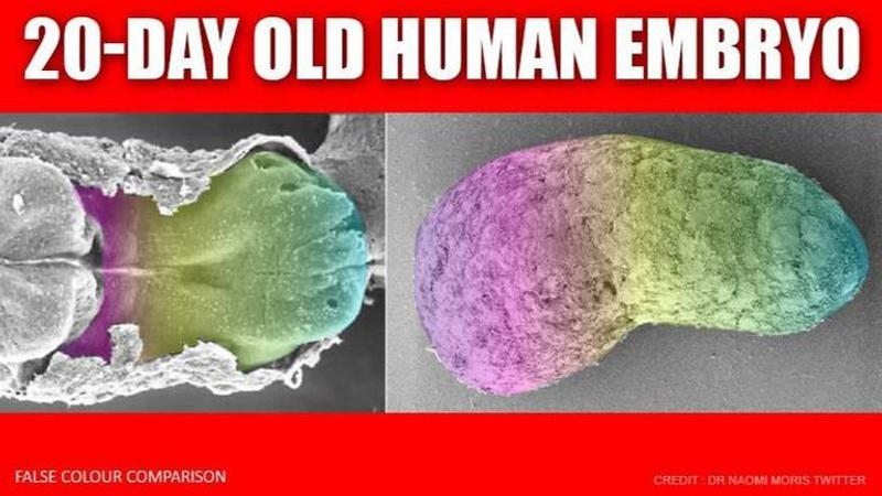 human embryo