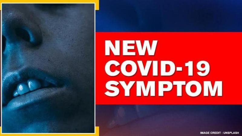 Mouth rashes a possible new symptom of COVID-19 claims Spanish study