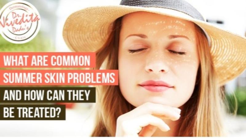 What Are Common Summer Skin Problems And How Can They Be Treated?