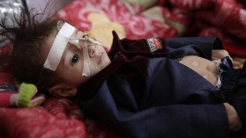 UNICEF seeks more aid for at-risk Mideast kids amid pandemic