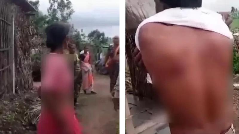 Six have been detained by local police for assaulting a woman over a land encroachment dispute in Ainapur village