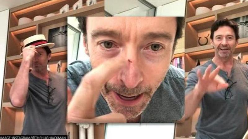 Hugh Jackman